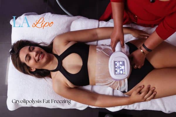 woman getting cryolipolysis Weston Super Mare