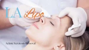 Woman receiving Actinic Keratosis Removal Treatment Weston Super Mare