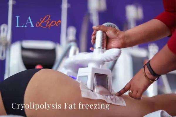 women getting fat freezing Weston Super Mare