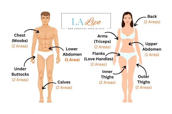 LA LIPO Cryolipolysis Areas Weston Super Mare