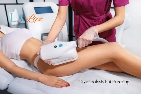 Woman receiving coolsculpting Weston Super Mare treatment on her thighs