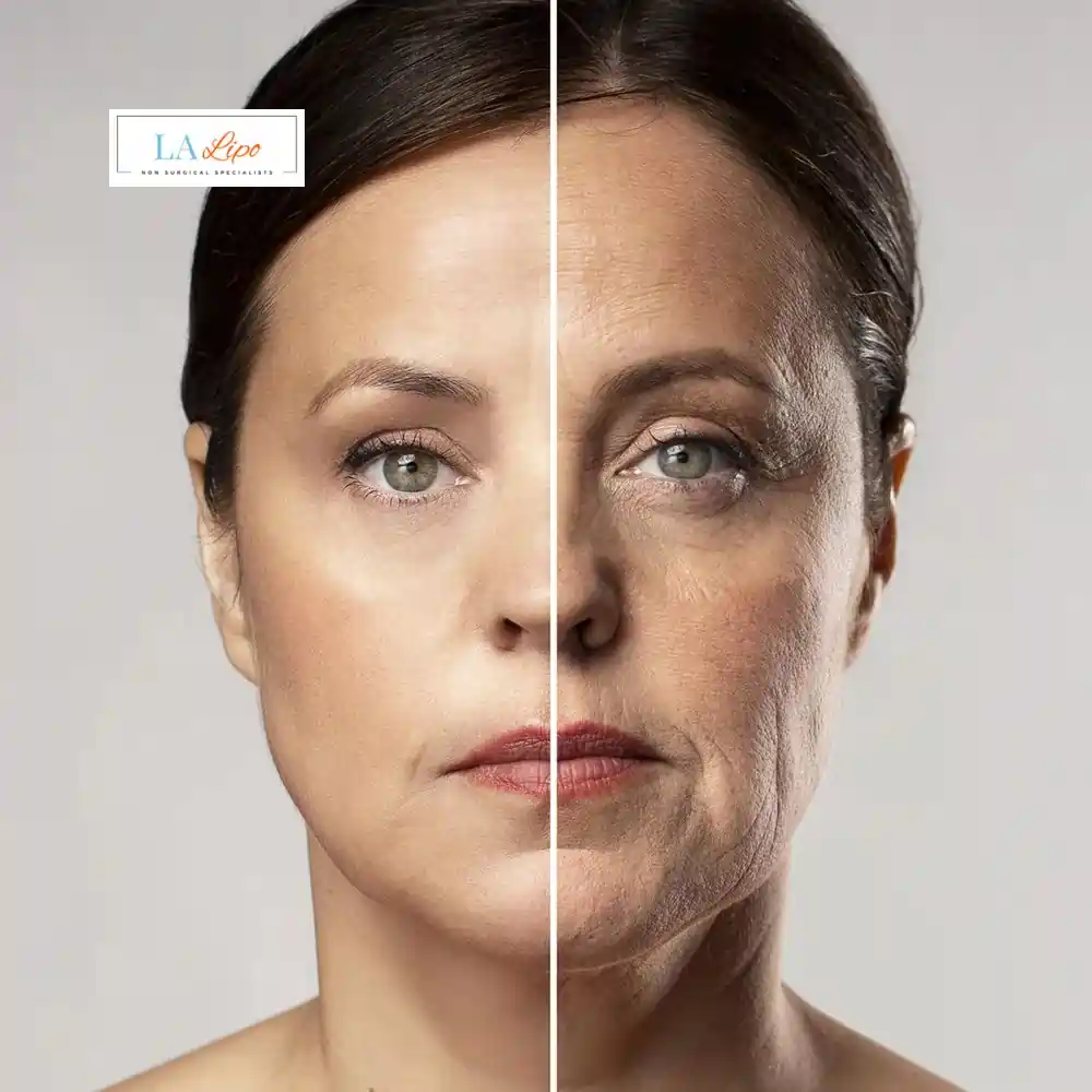 How Can You Tell If Non-Surgical Skin Tightening Is Right for You Weston Super Mare?
