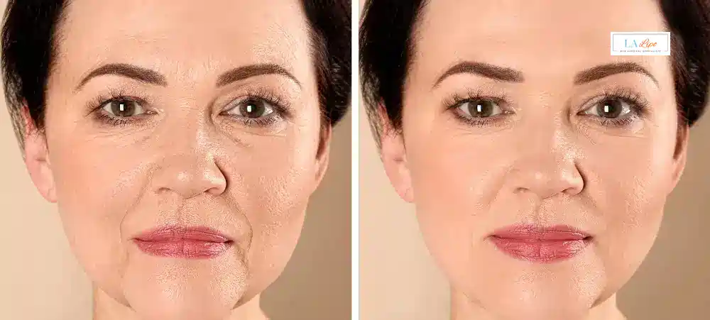 How Long Does It Take to See Results and How Long Do They Last Weston Super Mare?